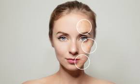 yaz-ayi-cilt-bakim-onerileri